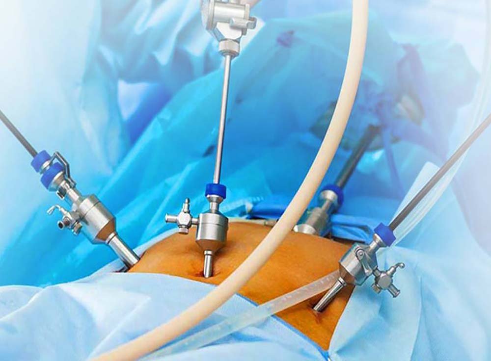 Laparoscopic Surgery Barrackpore